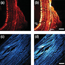 Figure 1a
