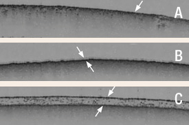 OCT Image of Coated Tablets