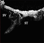 OCT image of human cochlea