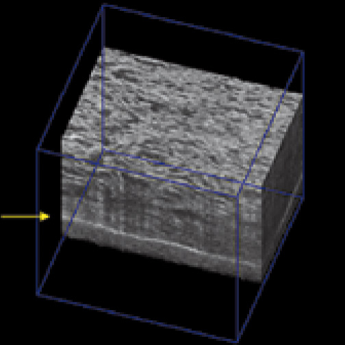 Cells in 3D scaffold