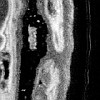 OCT image of rabgit epiglottis