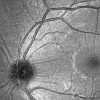 Large-area OCT scan of retina