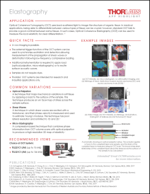 Elastography