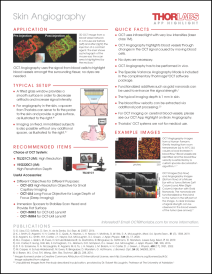 OCT Angiography