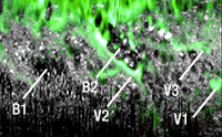 Double-Clad Coupler Combined OCT and Fluoresence Image