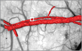 3D Doppler OCT 