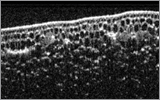 OCT Identifies Onion Defects