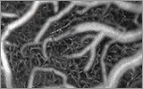 OCT Studies Cortical Microvasculature 